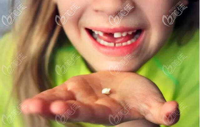 乳牙發(fā)育的重要性