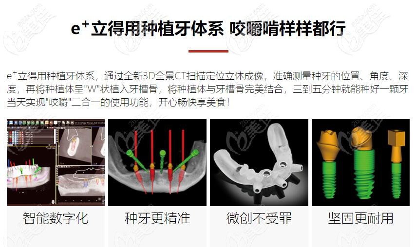 中諾自己研發(fā)的特色技術(shù)——立得用種植牙