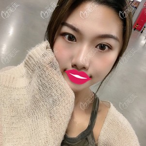 不想面部抽脂后一年臉有下垂問(wèn)題，就和我一樣選康美定制吸脂術(shù)