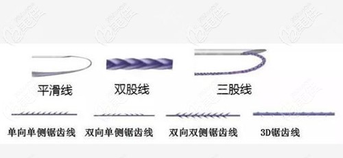 不同類型的鋸齒線