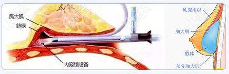 <!--<i data=20240703-sp></i>-->朱峻宏3C雙平面隆胸優(yōu)勢