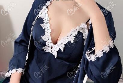 我做AD動感脂肪豐胸后乳房有波動感,做ad動感隆胸價格才5萬多