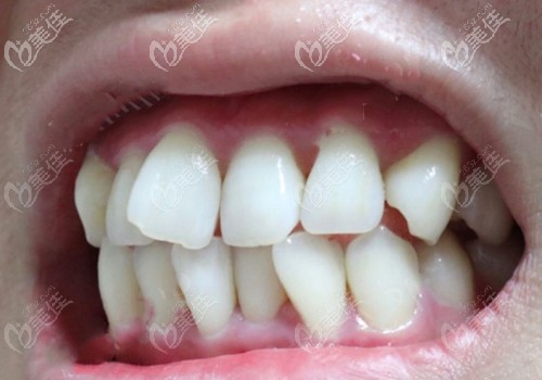 20210114_1610604903820869.jpg d752cd509323fc5ddf1b4e610d88a25e_570.jpg