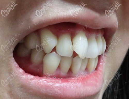 20210114_1610604970495407.jpg c14558154f3318b7d4645915147ffca4_570.jpg