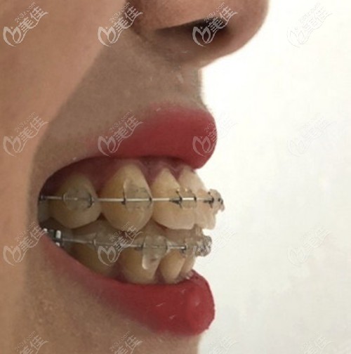 20210114_1610605223527615.jpg f5ce782e1b320458a7bc9fa0619f2645_570.jpg