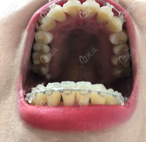 20210114_1610605229881224.jpg 5755edacfbdebb00f9114764ada92f23_570.jpg