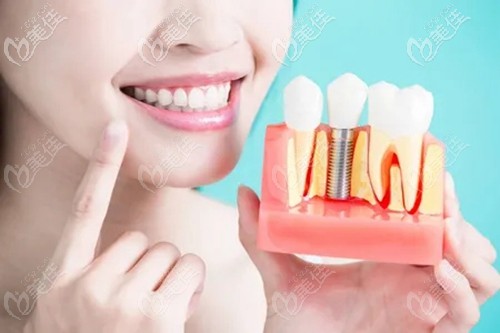 <!--<i data=20240703-sp></i>-->種植牙優(yōu)惠 <!--<i data=20240703-sp></i>-->種植牙優(yōu)惠