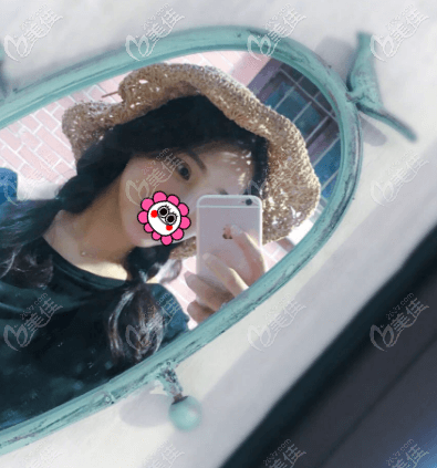 我做全切雙眼皮沒有出現(xiàn)越來越窄的情況 我做全切雙眼皮沒有出現(xiàn)越來越窄的情況