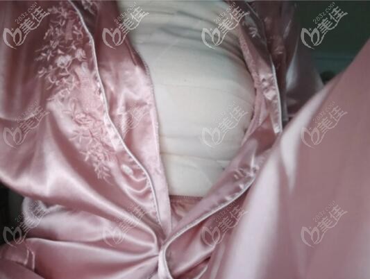 傲諾拉隆胸真實感受