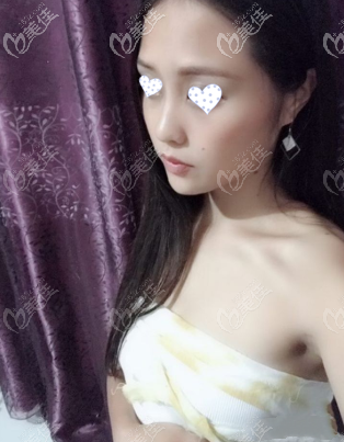 半個(gè)月后 半個(gè)月后