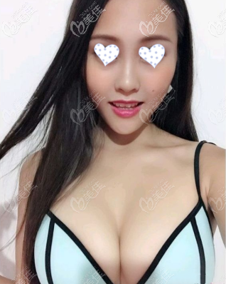 傲諾拉璀璨250cc290cc效果圖 傲諾拉璀璨250cc290cc效果圖