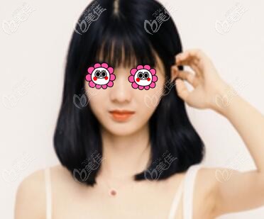 上下唇厚的我花了不到5000元做了厚唇改薄術(shù)，一個月后成功擁有迷人微笑唇！