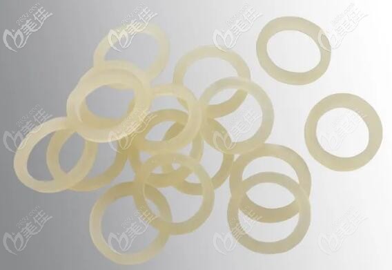 正畸橡皮圈 正畸橡皮圈