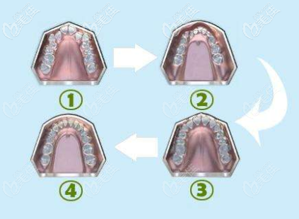 MRC兒童矯正 MRC兒童矯正