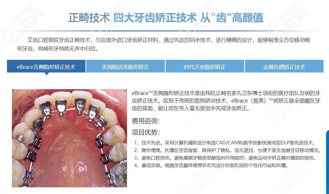 艾齒口腔四大正畸技術(shù)