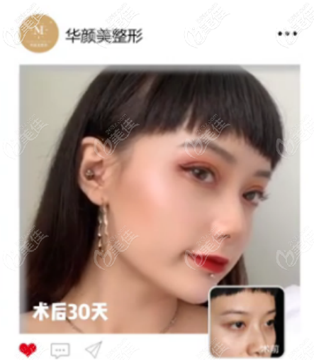 黑眼珠的暴露率剛剛好 黑眼珠的暴露率剛剛好