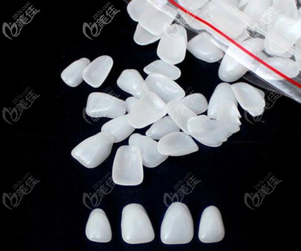 牙齒貼面材料類型