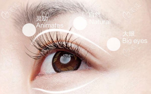 玉林華美哪個醫(yī)生做雙眼皮好 玉林華美哪個醫(yī)生做雙眼皮好