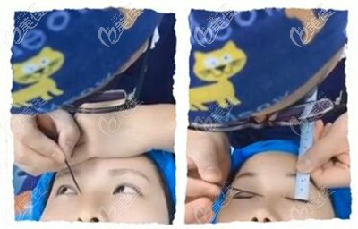 楊小順醫(yī)生方案設(shè)計