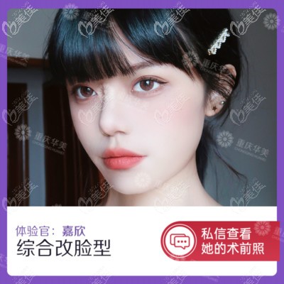 重慶華美潘寶華醫(yī)生磨骨案例風(fēng)格偏網(wǎng)紅風(fēng)