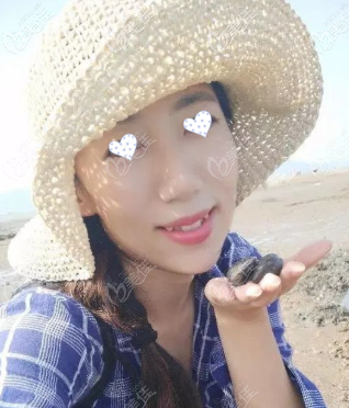 戴牙套前照片 戴牙套前照片