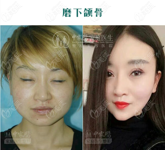 聶云飛磨骨怎么樣 聶云飛磨骨怎么樣