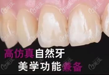 愛爾創(chuàng)魅影 愛爾創(chuàng)魅影