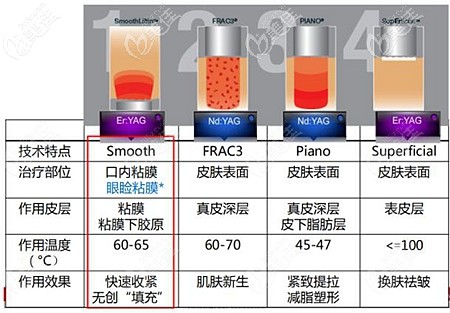 歐洲之星fotona4d提升面部的價格