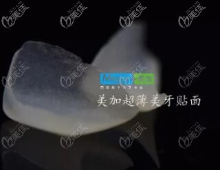 美加超薄瓷貼面 美加超薄瓷貼面