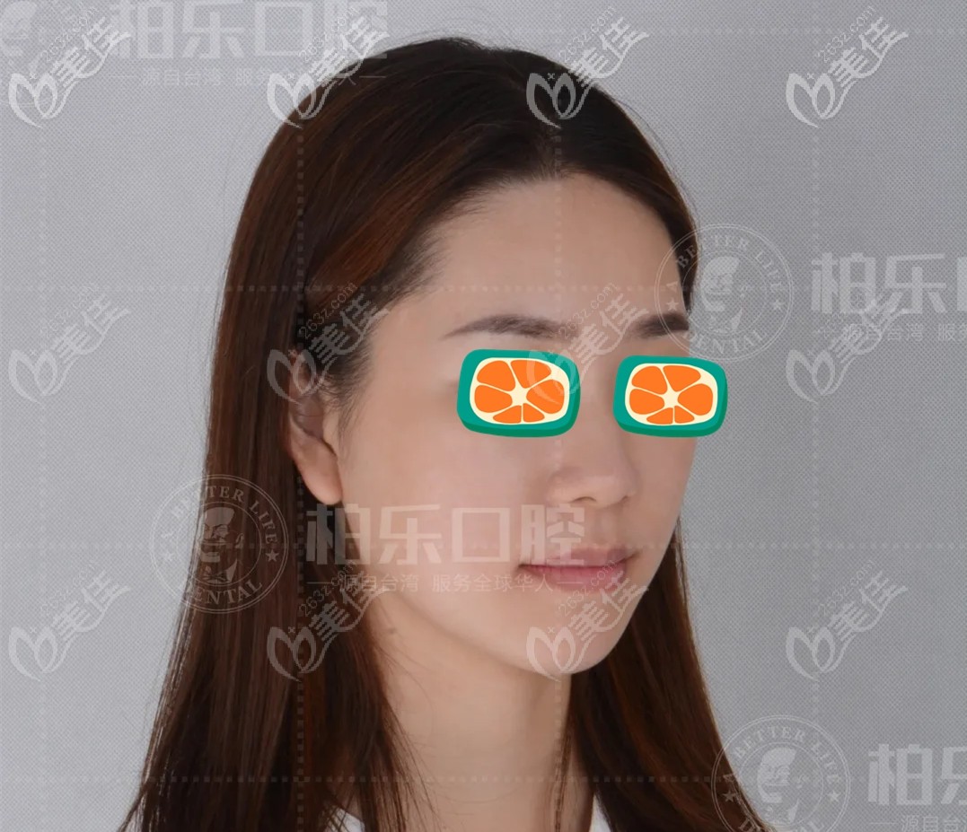 下唇突出，面部凹陷