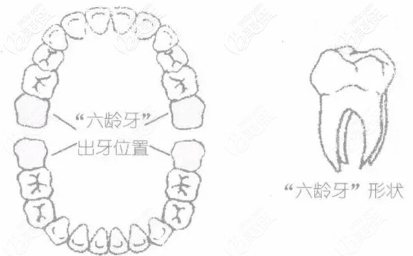 六齡齒所在的位置及形狀圖片