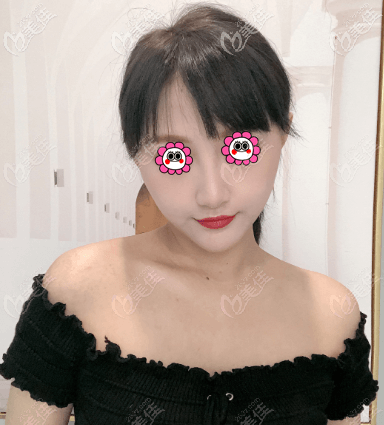 北京如朵肋軟骨鼻綜合 北京如朵肋軟骨鼻綜合