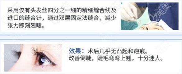宜春華美割雙眼皮技術(shù)優(yōu)勢