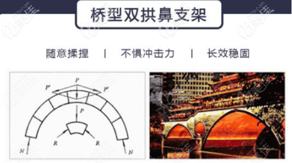 徐立志醫(yī)生橋拱隆鼻理念 徐立志醫(yī)生橋拱隆鼻理念