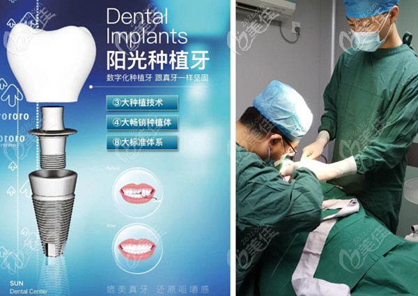 陳鵬主任的種植手術(shù)現(xiàn)場(chǎng)圖 陳鵬主任的種植手術(shù)現(xiàn)場(chǎng)圖