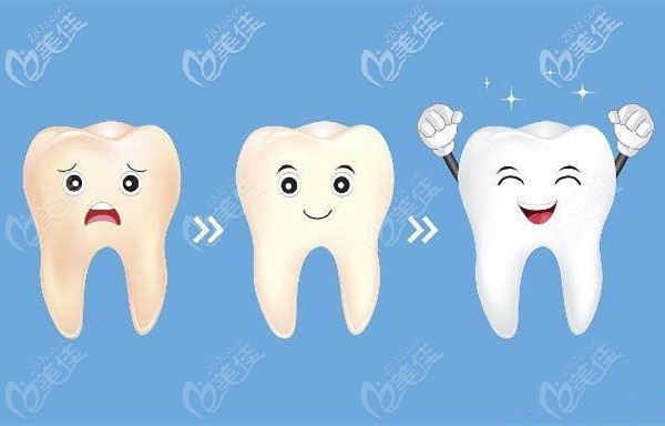 口腔牙齒美白價格 口腔牙齒美白價格