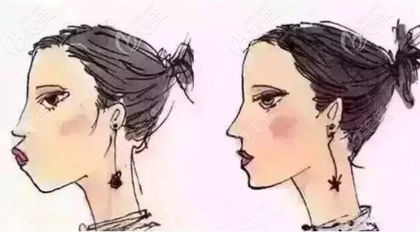 <!--<i data=20240703-sp></i>-->口腔矯正牙齒的案例 <!--<i data=20240703-sp></i>-->口腔矯正牙齒的案例