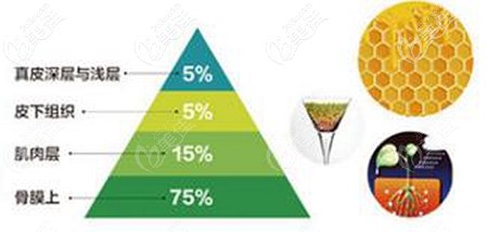 張讓虎做脂肪填充面部的優(yōu)勢