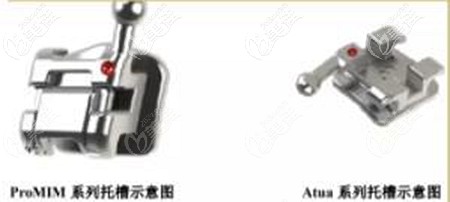 埃蒙迪自鎖托槽的質(zhì)量如何