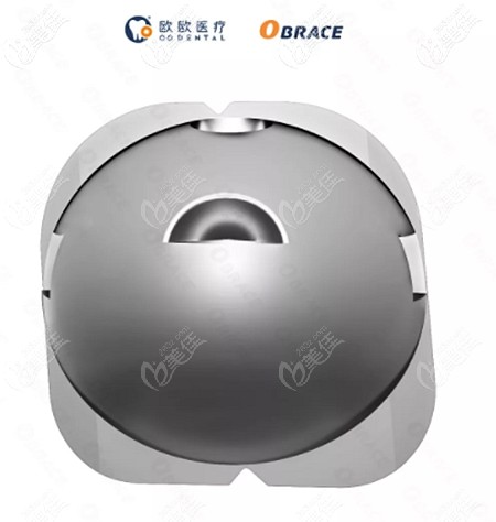 球托牙套的優(yōu)缺點(diǎn)