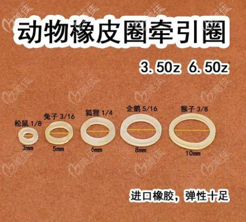 正畸牙套橡皮圈的型號和力量大小