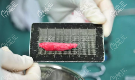 取出的膨體材料