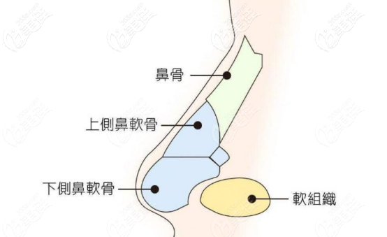 硅膠隆鼻應該剝離的腔隙的位置