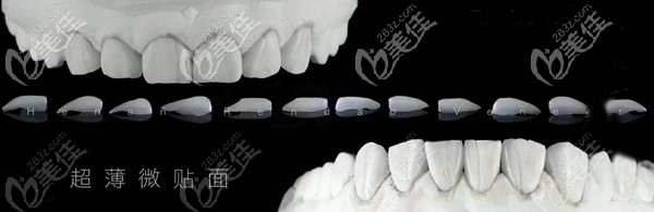 加工廠給我制作的超薄全瓷貼面 加工廠給我制作的超薄全瓷貼面