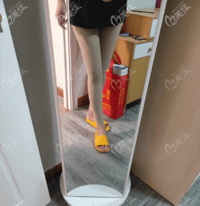 北京達(dá)美如藝大腿環(huán)吸半個多月了