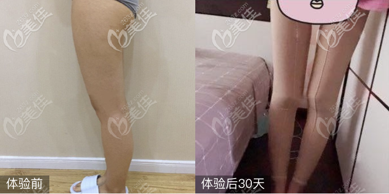 <!--<i data=20240703-sp></i>-->整形醫(yī)院袁野醫(yī)生是深圳很厲害的吸脂醫(yī)生 <!--<i data=20240703-sp></i>-->整形醫(yī)院袁野醫(yī)生是深圳很厲害的吸脂醫(yī)生