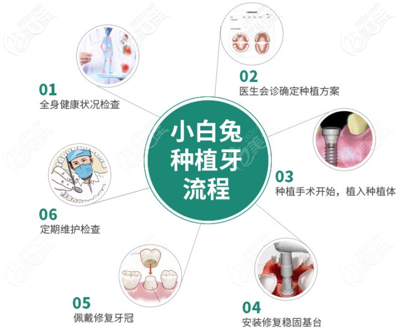 烏魯木齊小白兔口腔種一顆美國(guó)皓圣種植體的價(jià)格便宜啦~
