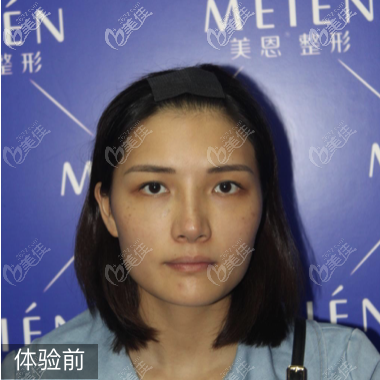 廣州美恩沈紹勇做磨骨技術(shù)怎么樣 廣州美恩沈紹勇做磨骨技術(shù)怎么樣