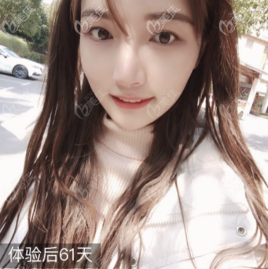 廣州沈紹勇做磨骨怎么樣?沈紹勇下頜角技術(shù)我親身體驗過比較有發(fā)言權(quán)