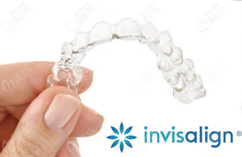 隱適美隱形矯正